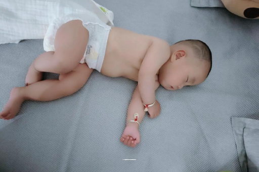 正定六个月宝宝眼睛散光